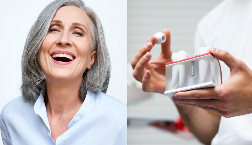 Implants dentaires Implants dentaires