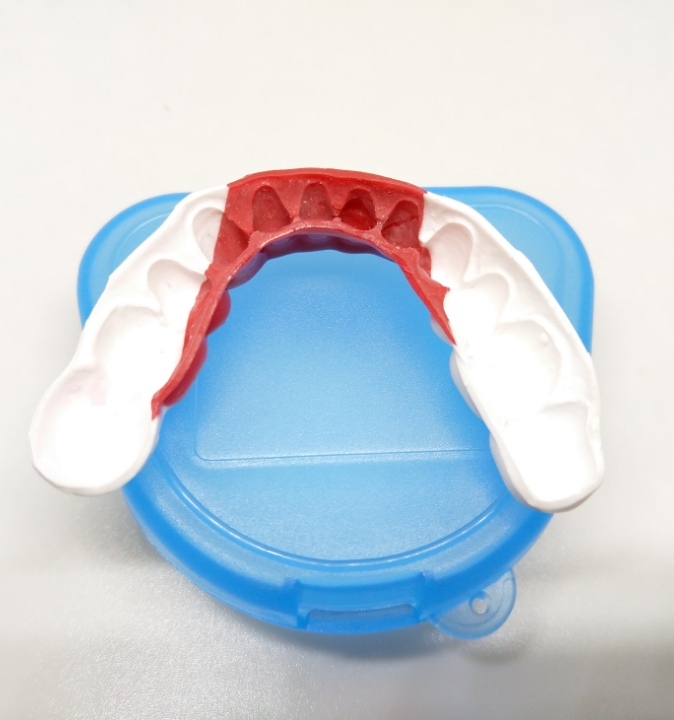 Le protecteur buccal : pour limiter les risques de la pratique sportive Le protecteur buccal : pour limiter les risques de la pratique sportive